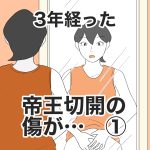 【新連載・1】3年経った、帝王切開の傷が…